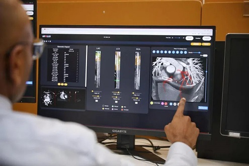 AI System For Faster Detection Of Coronary Artery Disease To Be Trialled At 3 S’pore Hospitals